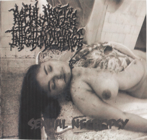 Rectal Abscess Infection Discharge : Sexual Necropsy